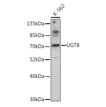 Western Blot - Anti-CGT Antibody (A91032) - Antibodies.com
