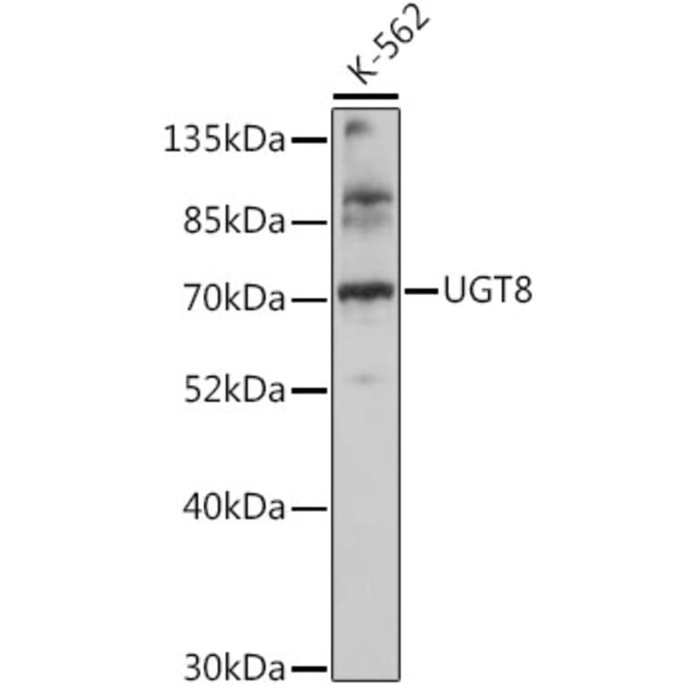 Western Blot - Anti-CGT Antibody (A91032) - Antibodies.com