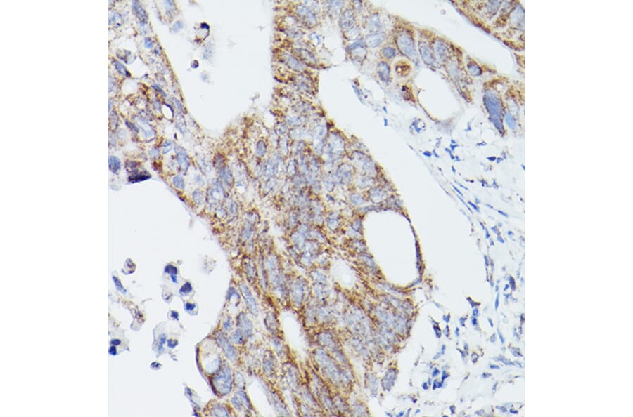 Immunohistochemistry - Anti-ATG16L1 Antibody (A91033) - Antibodies.com