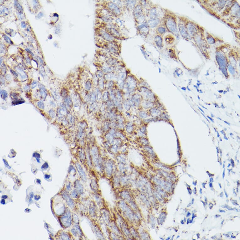 Immunohistochemistry - Anti-ATG16L1 Antibody (A91033) - Antibodies.com