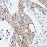 Immunohistochemistry - Anti-ATG16L1 Antibody (A91033) - Antibodies.com