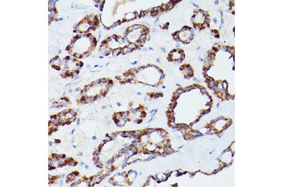 Immunohistochemistry - Anti-ATG16L1 Antibody (A91033) - Antibodies.com