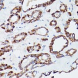 Immunohistochemistry - Anti-ATG16L1 Antibody (A91033) - Antibodies.com