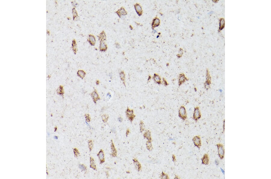 Immunohistochemistry - Anti-ATG16L1 Antibody (A91033) - Antibodies.com