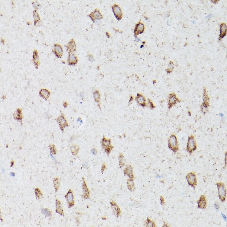 Immunohistochemistry - Anti-ATG16L1 Antibody (A91033) - Antibodies.com