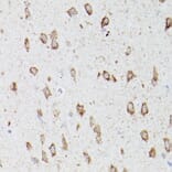 Immunohistochemistry - Anti-ATG16L1 Antibody (A91033) - Antibodies.com