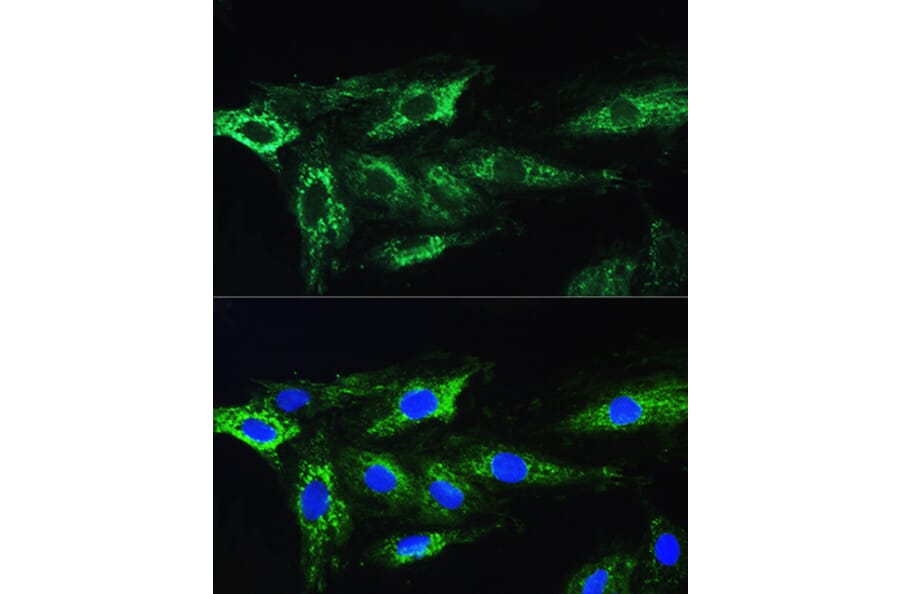 Immunofluorescence - Anti-ATG16L1 Antibody (A91033) - Antibodies.com