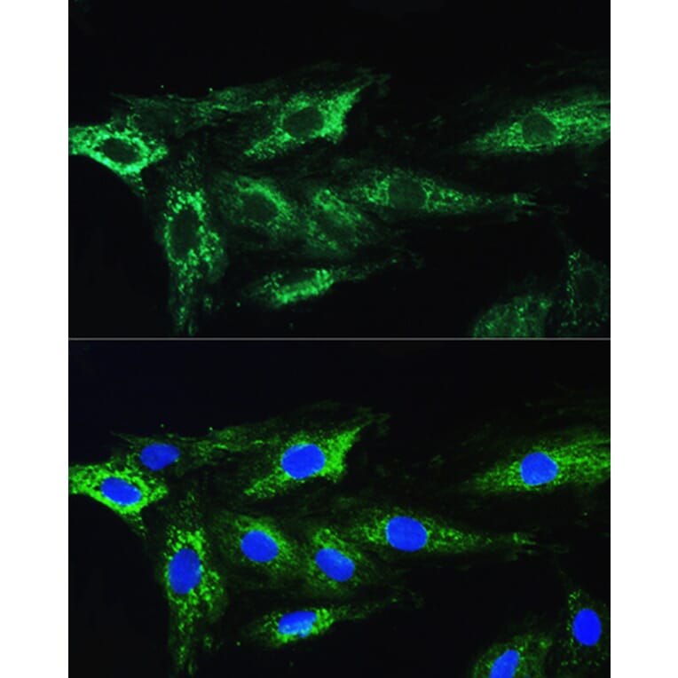 Immunofluorescence - Anti-ATG16L1 Antibody (A91033) - Antibodies.com