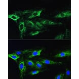 Immunofluorescence - Anti-ATG16L1 Antibody (A91033) - Antibodies.com