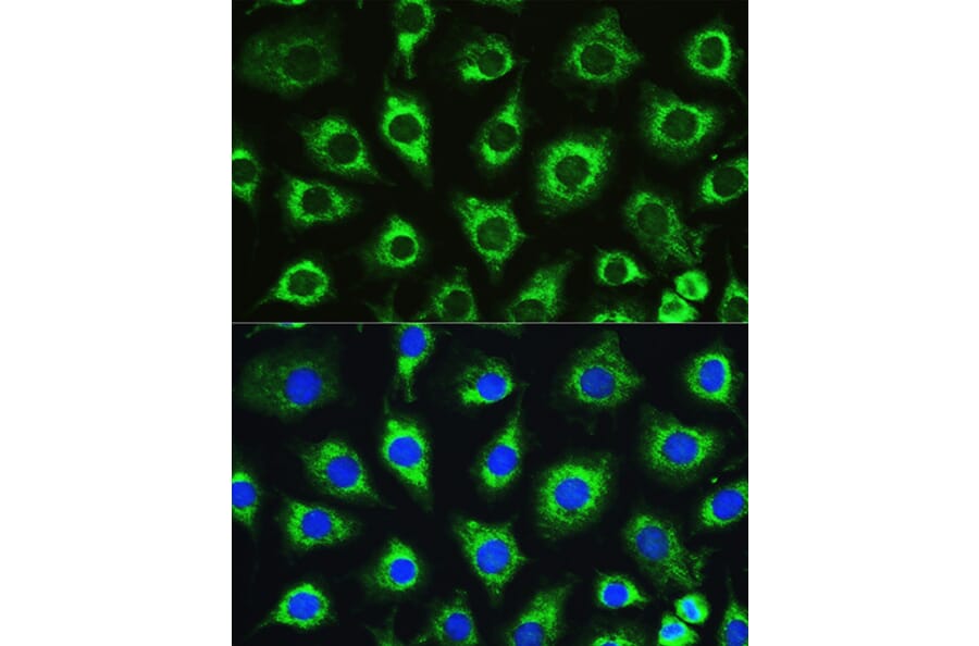 Immunofluorescence - Anti-ATG16L1 Antibody (A91033) - Antibodies.com