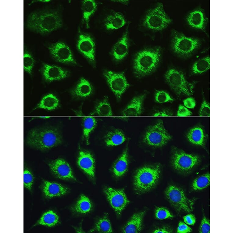 Immunofluorescence - Anti-ATG16L1 Antibody (A91033) - Antibodies.com