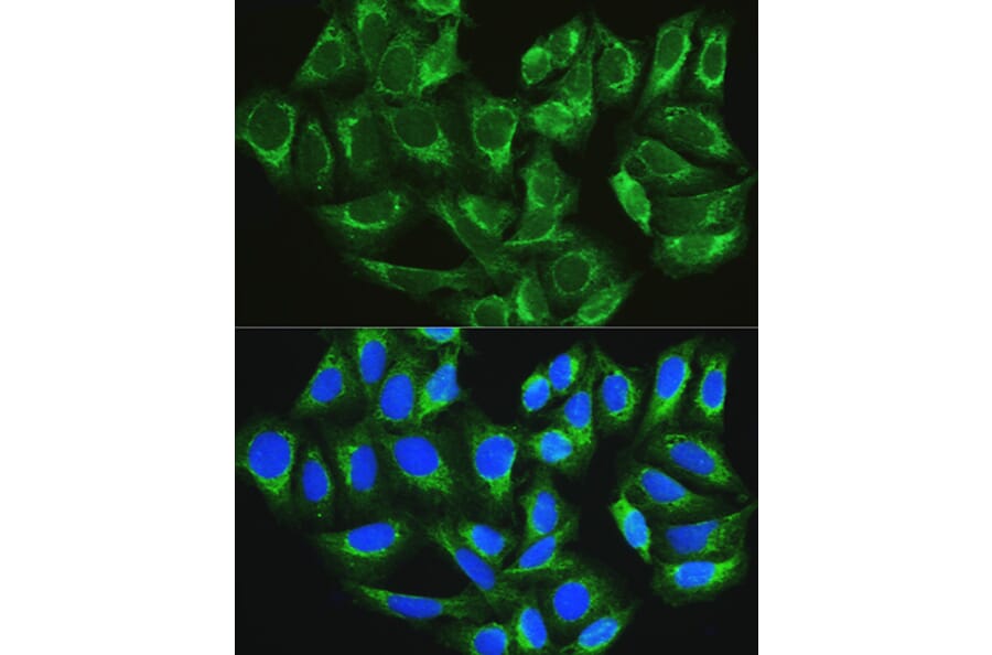 Immunofluorescence - Anti-ATG16L1 Antibody (A91033) - Antibodies.com