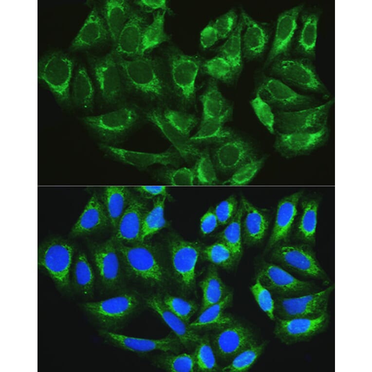 Immunofluorescence - Anti-ATG16L1 Antibody (A91033) - Antibodies.com