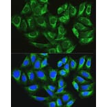 Immunofluorescence - Anti-ATG16L1 Antibody (A91033) - Antibodies.com