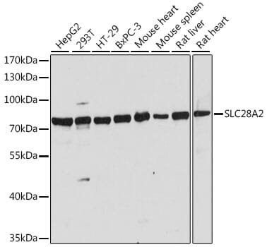 Western blot analysis of extracts of various cell lines, using Anti-SLC28A2 Antibody (A16086) at 1:1,000 dilution.
Secondary antibody: Goat Anti-Rabbit IgG (H+L) (HRP) (AS014) at 1:10,000 dilution.
Lysates / proteins: 25µg per lane.
Blocking buffer: 3% non-fat dry milk in TBST.
Detection: ECL Basic Kit (RM00020).
Exposure time: 5s.