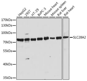 Western Blot - Anti-SLC28A2 Antibody (A91034) - Antibodies.com