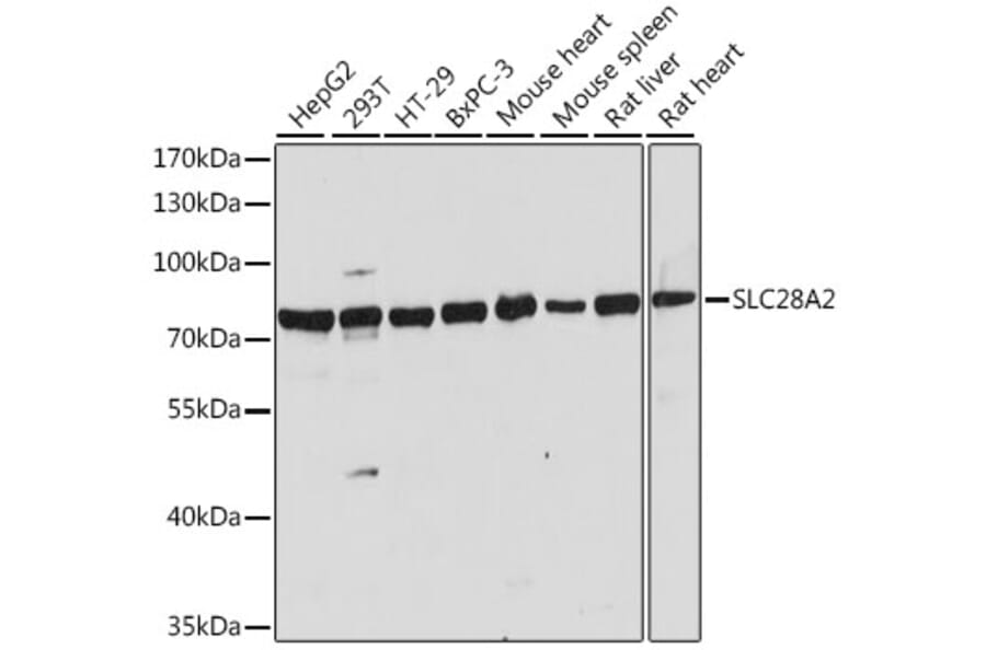 Western Blot - Anti-SLC28A2 Antibody (A91034) - Antibodies.com