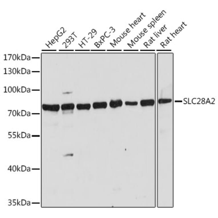 Western Blot - Anti-SLC28A2 Antibody (A91034) - Antibodies.com