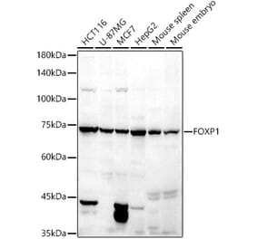 Western Blot - Anti-FOXP1 Antibody (A91035) - Antibodies.com