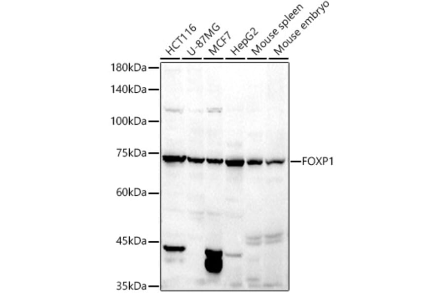 Western Blot - Anti-FOXP1 Antibody (A91035) - Antibodies.com