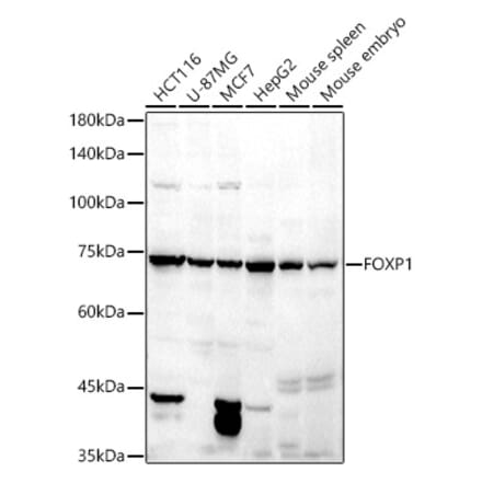 Western Blot - Anti-FOXP1 Antibody (A91035) - Antibodies.com