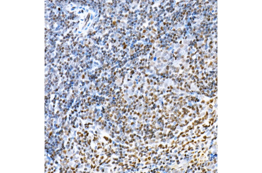 Immunohistochemistry - Anti-FOXP1 Antibody (A91035) - Antibodies.com