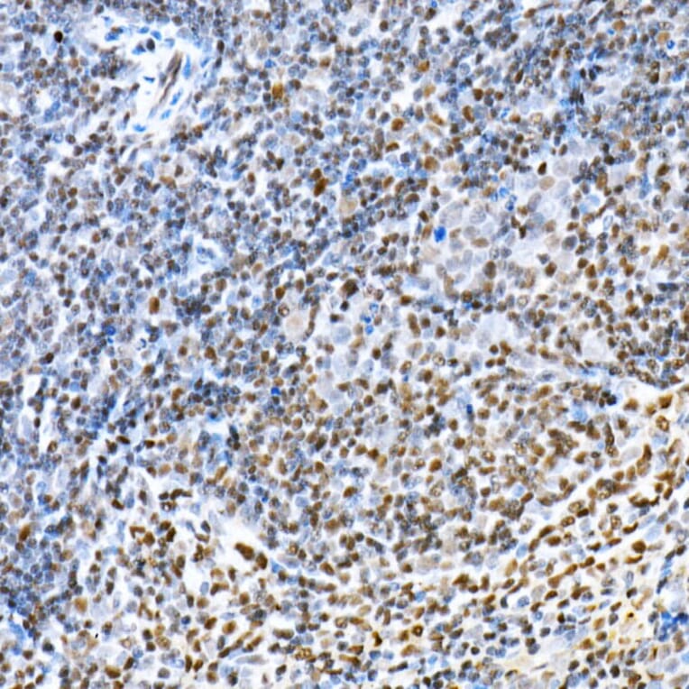 Immunohistochemistry - Anti-FOXP1 Antibody (A91035) - Antibodies.com