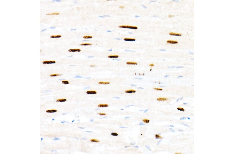 Immunohistochemistry - Anti-FOXP1 Antibody (A91035) - Antibodies.com