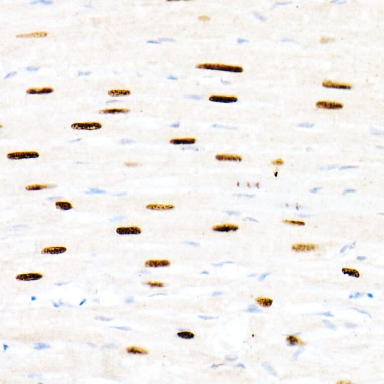 Immunohistochemistry - Anti-FOXP1 Antibody (A91035) - Antibodies.com