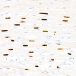 Immunohistochemistry - Anti-FOXP1 Antibody (A91035) - Antibodies.com