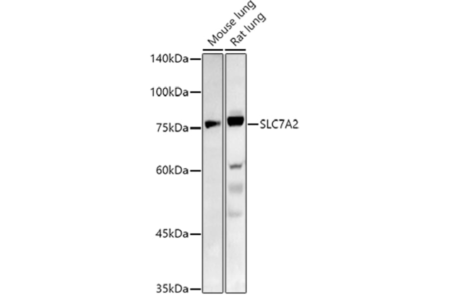 Western Blot - Anti-SLC7A2 / CAT2 Antibody (A91036) - Antibodies.com