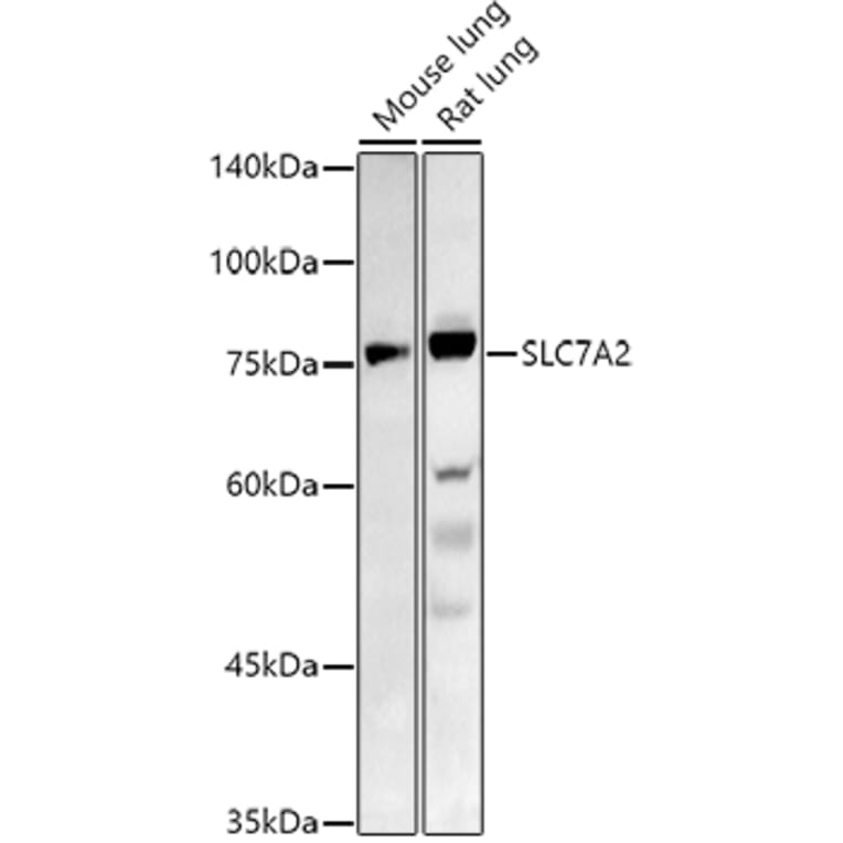 Western Blot - Anti-SLC7A2 / CAT2 Antibody (A91036) - Antibodies.com