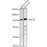 Western Blot - Anti-SLC7A2 / CAT2 Antibody (A91036) - Antibodies.com