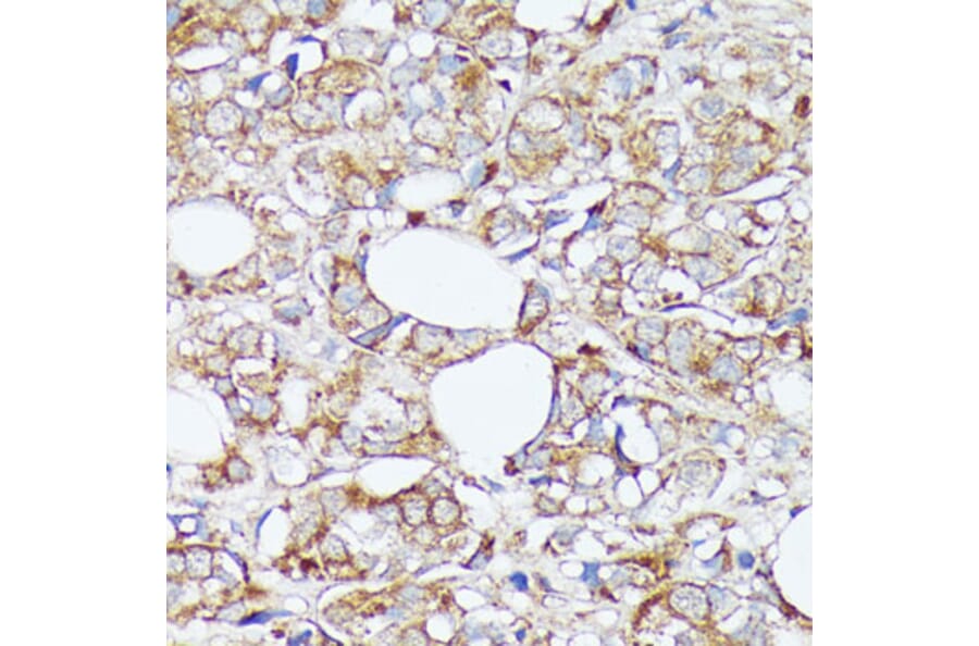 Immunohistochemistry - Anti-SLC7A2 / CAT2 Antibody (A91036) - Antibodies.com