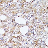 Immunohistochemistry - Anti-SLC7A2 / CAT2 Antibody (A91036) - Antibodies.com