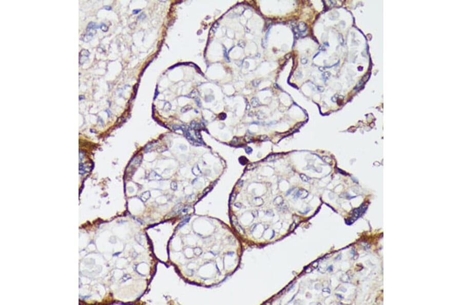 Immunohistochemistry - Anti-SLC7A2 / CAT2 Antibody (A91036) - Antibodies.com