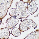 Immunohistochemistry - Anti-SLC7A2 / CAT2 Antibody (A91036) - Antibodies.com
