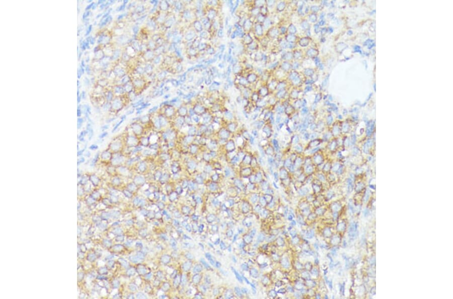 Immunohistochemistry - Anti-SLC7A2 / CAT2 Antibody (A91036) - Antibodies.com