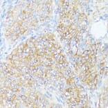 Immunohistochemistry - Anti-SLC7A2 / CAT2 Antibody (A91036) - Antibodies.com