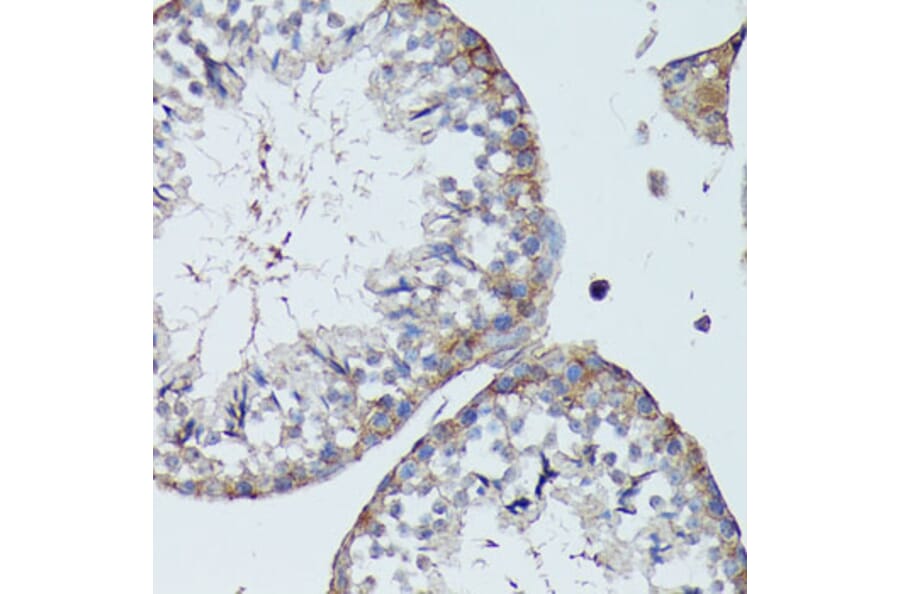 Immunohistochemistry - Anti-SLC7A2 / CAT2 Antibody (A91036) - Antibodies.com