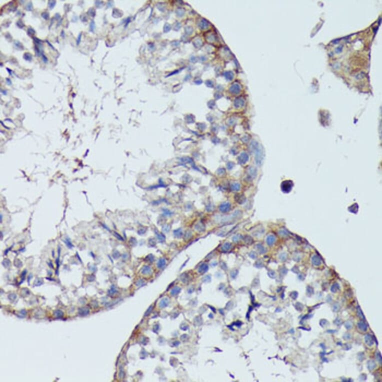 Immunohistochemistry - Anti-SLC7A2 / CAT2 Antibody (A91036) - Antibodies.com