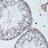 Immunohistochemistry - Anti-SLC7A2 / CAT2 Antibody (A91036) - Antibodies.com