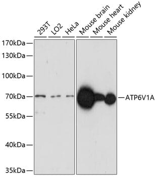 Western blot analysis of extracts of various cell lines, using Anti-ATP6V1A Antibody (A14706) at 1:1,000 dilution.
Secondary antibody: Goat Anti-Rabbit IgG (H+L) (HRP) (AS014) at 1:10,000 dilution.
Lysates / proteins: 25µg per lane.
Blocking buffer: 3% non-fat dry milk in TBST.
Detection: ECL Basic Kit (RM00020).
Exposure time: 3min.