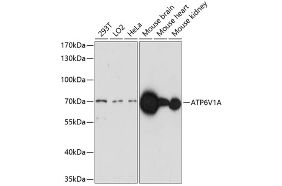 Western Blot - Anti-ATP6V1A Antibody (A91037) - Antibodies.com