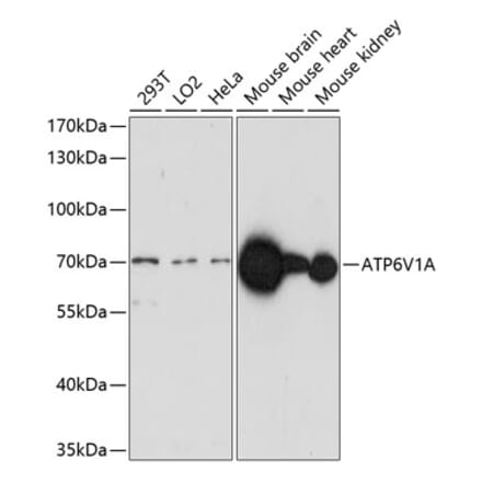 Western Blot - Anti-ATP6V1A Antibody (A91037) - Antibodies.com