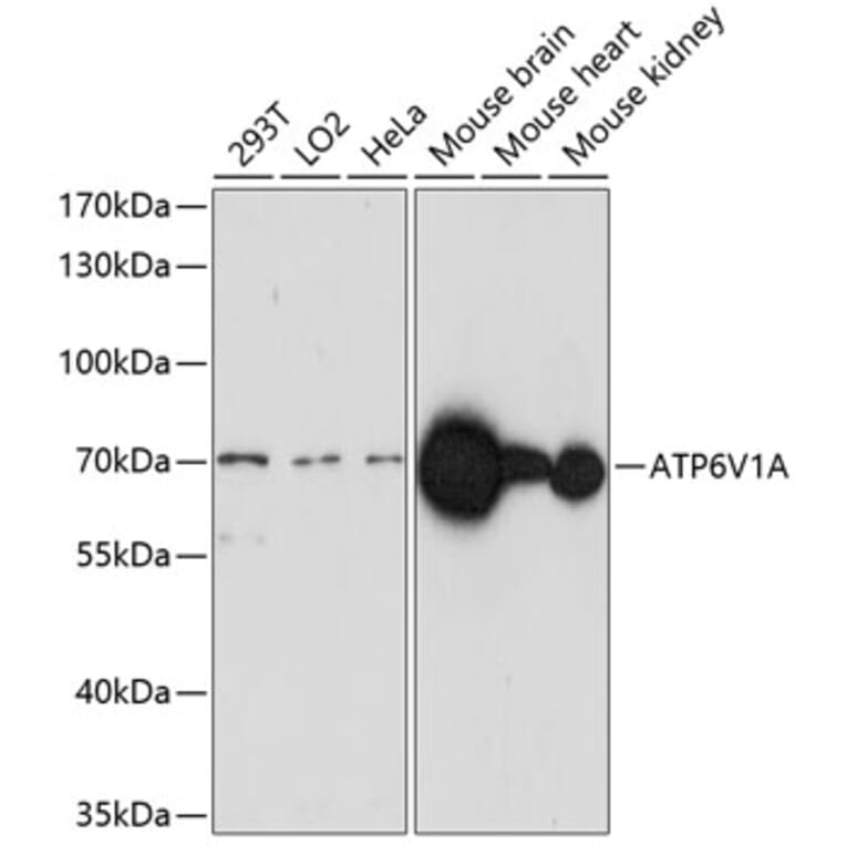 Western Blot - Anti-ATP6V1A Antibody (A91037) - Antibodies.com