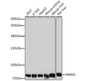 Western Blot - Anti-FREM1 Antibody (A91038) - Antibodies.com