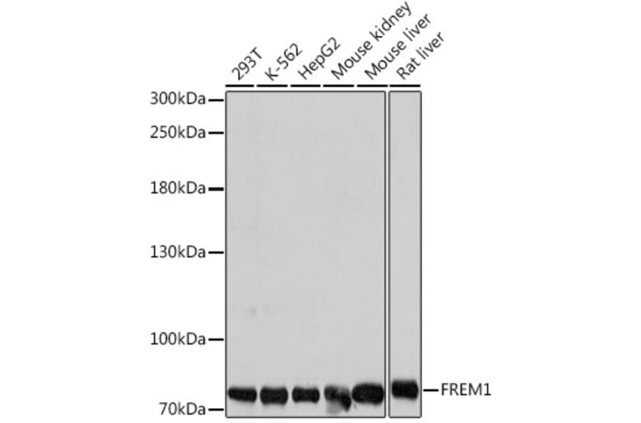 Western Blot - Anti-FREM1 Antibody (A91038) - Antibodies.com