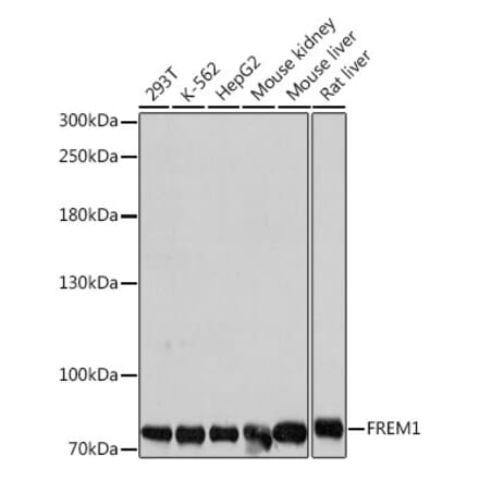 Western Blot - Anti-FREM1 Antibody (A91038) - Antibodies.com