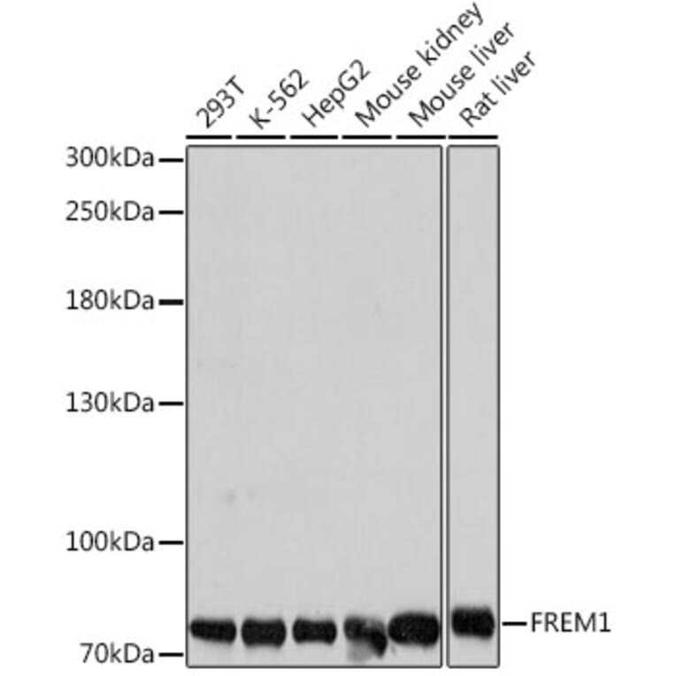 Western Blot - Anti-FREM1 Antibody (A91038) - Antibodies.com